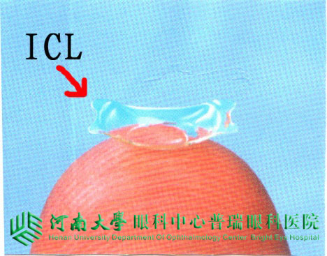 ICL植入術，高度近視患者的福音