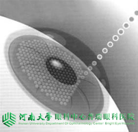 近視度數不同，手術方式怎么選