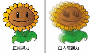 白內障誘發原因大解析