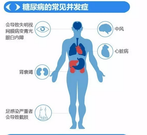 你造嗎？糖尿病晚期眼睛會致盲！