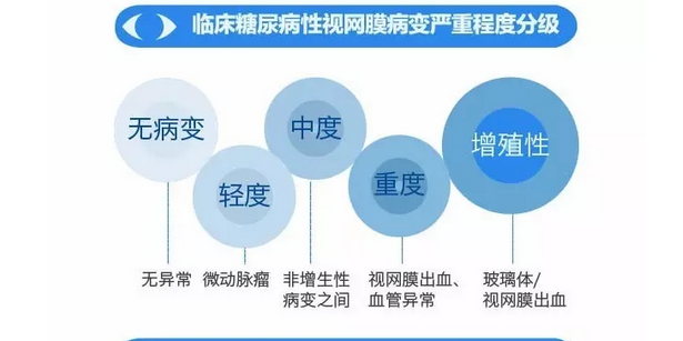 你造嗎？糖尿病晚期眼睛會致盲！