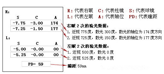 眼科醫生教你如何一分鐘看懂驗光單！