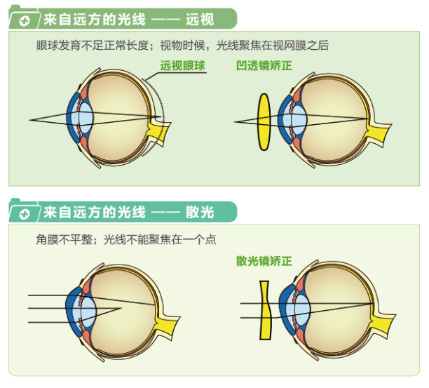 【看圖解】一張圖教你看懂近視、遠視和散光