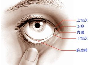 淚道病，眼部的隱形威脅