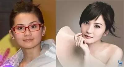 那些近視戴鏡暴丑的女明星們是做了什么變美了？？？